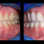 Cosmetic Dentist Hollywood Smile Gallery 25