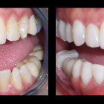 Cosmetic Dentist Hollywood Smile Gallery 26