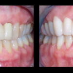 Cosmetic Dentist Hollywood Smile Gallery 31