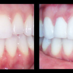 Cosmetic Dentist Hollywood Smile Gallery 22